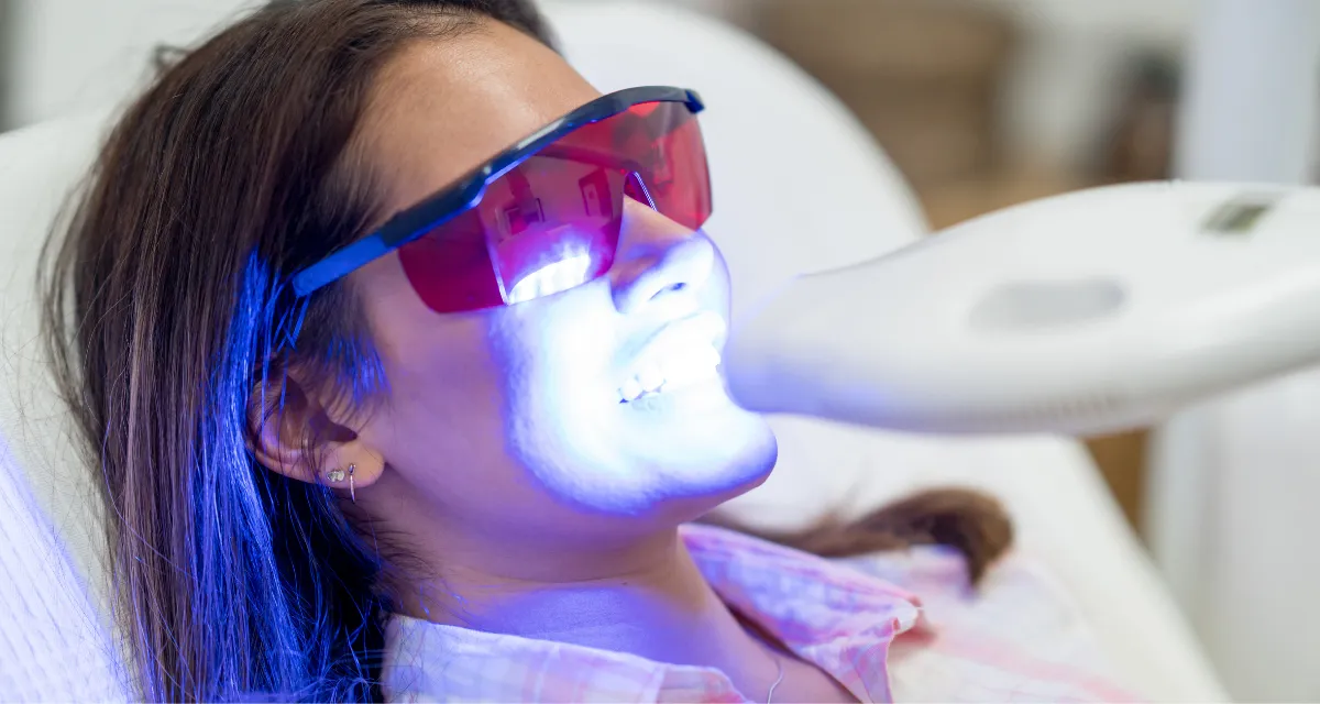Teeth Whitening